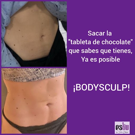 bodysculp
